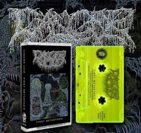 CANCER VOID - First Metastasis (cassette)