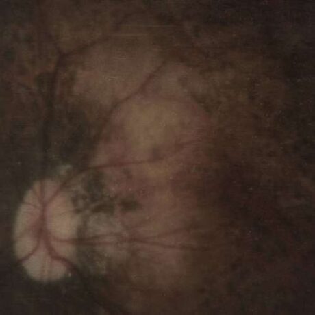 PALE SPEKTRE - Bereft of Xerotic Layers