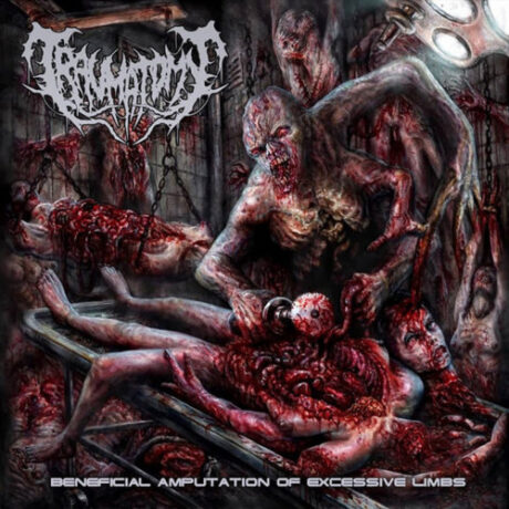 TRAUMATOMY - Beneficial Amputation Of Excessive Limbs